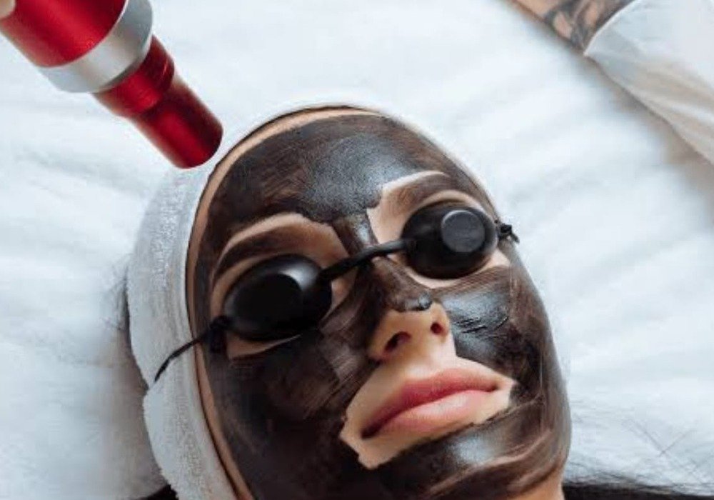 Carbon Facial treatment at Adrin's Glo